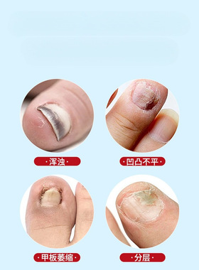 4ml6支装新灰甲凝胶笔指甲凝胶保护指甲养护合一无需拔甲养护指甲