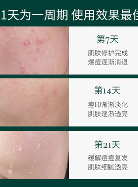 广州佩兰贝生物科技有限公司寡肽祛痘淡化痘印闭口修护冻干粉