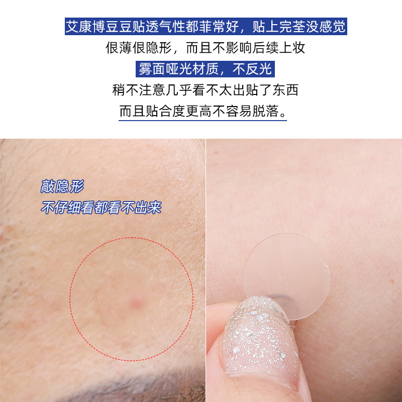 日本进口ACNES LABO艾康博祛痘膏去粉刺青春痘去闭口痘印祛痘点霜