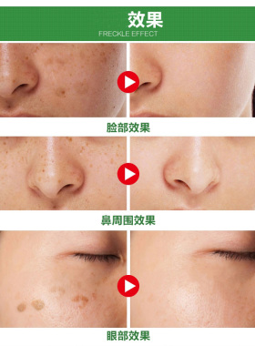 红白瓶中药祛斑霜美白护肤套装
