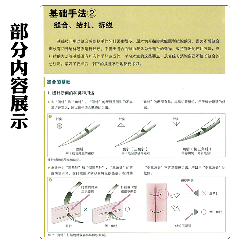 正版拔牙技巧必成高手吴松涛吴斌译拔牙方法手法麻醉处置应对辽宁科学技术出版社 9787559114891-图2