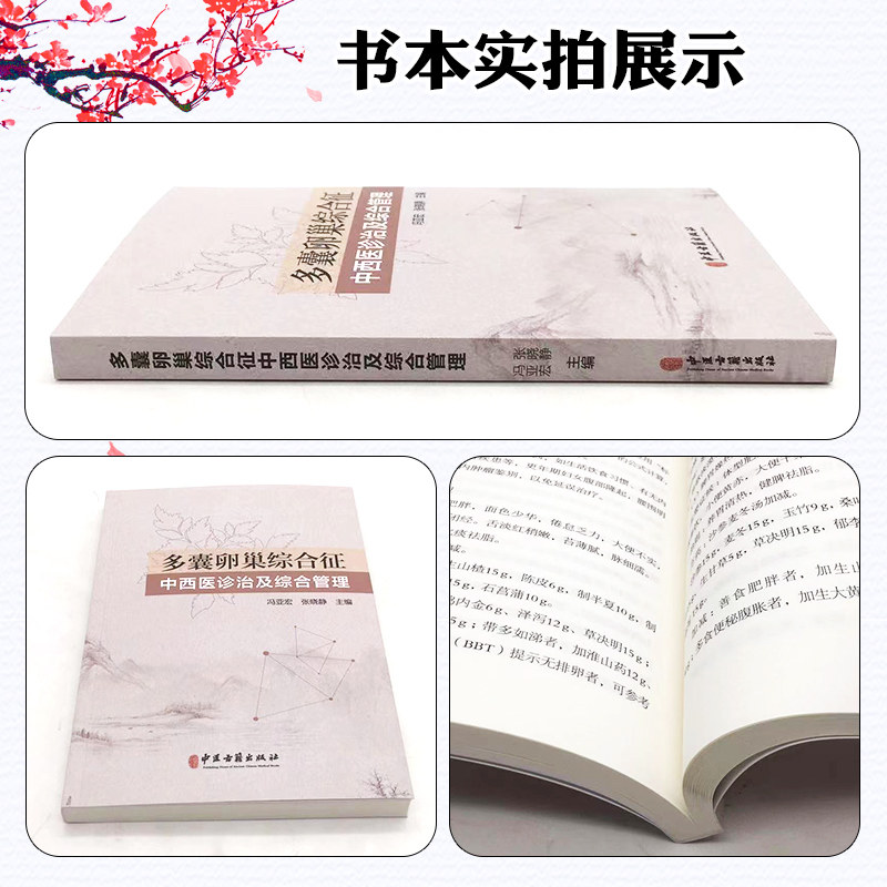 多囊卵巢综合征中西医诊治及综合管理 中医古籍出版社 9787515224763