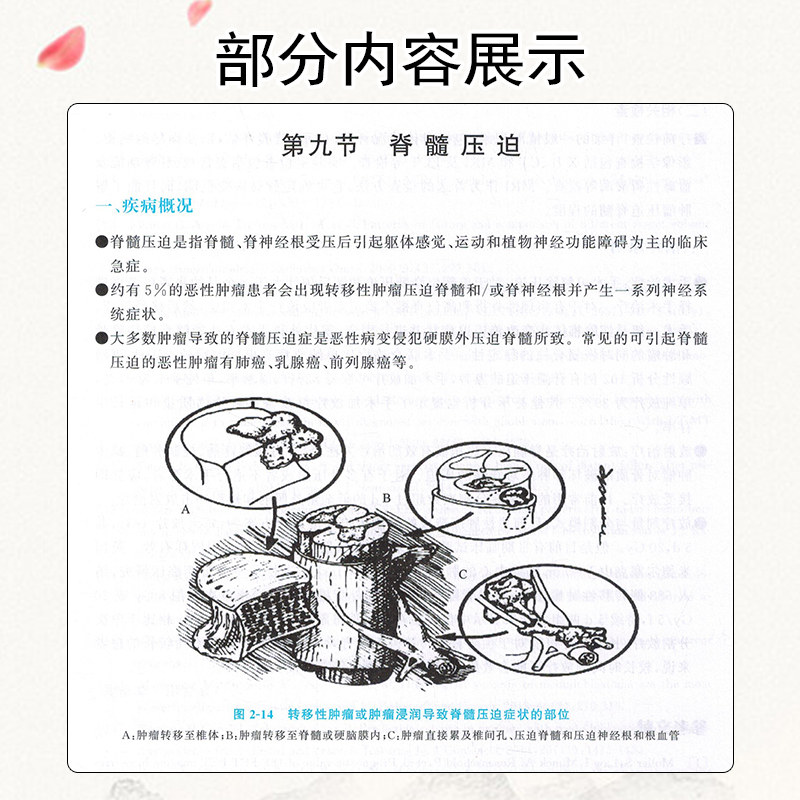 正版肿瘤精准放射治疗学临床要点 陕西人卫图书临床医学