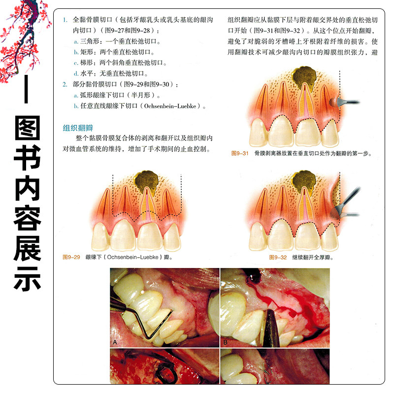 任选 牙髓之路第11版 侯晓玫 根管治疗图谱正畸书籍拔牙技巧 根管治疗书籍口腔种植书籍 口腔医学书籍牙科书籍 辽宁科学技术出版社