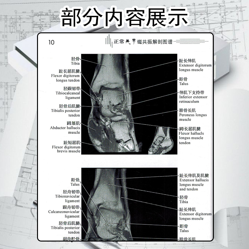 正版医学影像解学解剖图谱丛书正常关节磁共振解剖图谱主编李明华姚伟武上海科学技术出版社9787532397693-图3