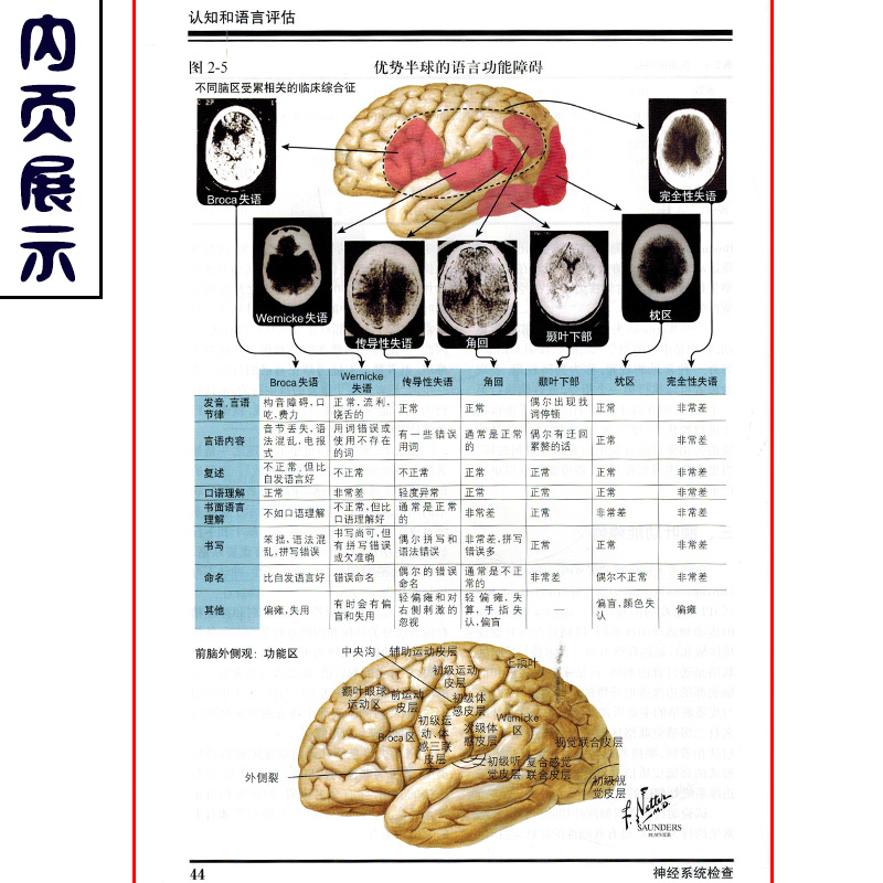 正版 奈特神经系统疾病彩色图谱 神经内科学参考工具书籍临床解剖教程 主译樊东升 张俊译 人民卫生出版社9787117107013 - 图2