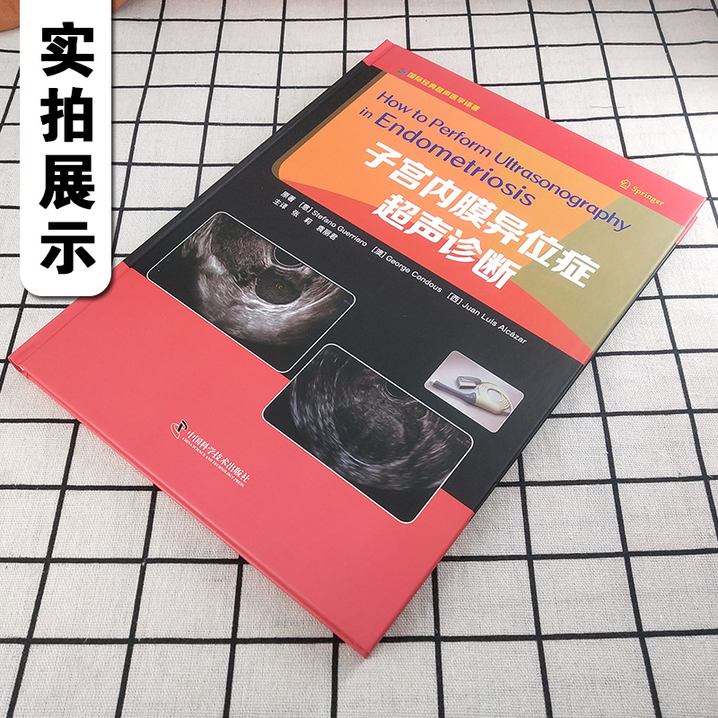 w正版 子宫内膜异位症超声诊断 主编张莉 袁丽君 妇产科疾病临床案例诊治教程 医学影像解读书籍 中国科学技术出版社9787504684134 - 图0