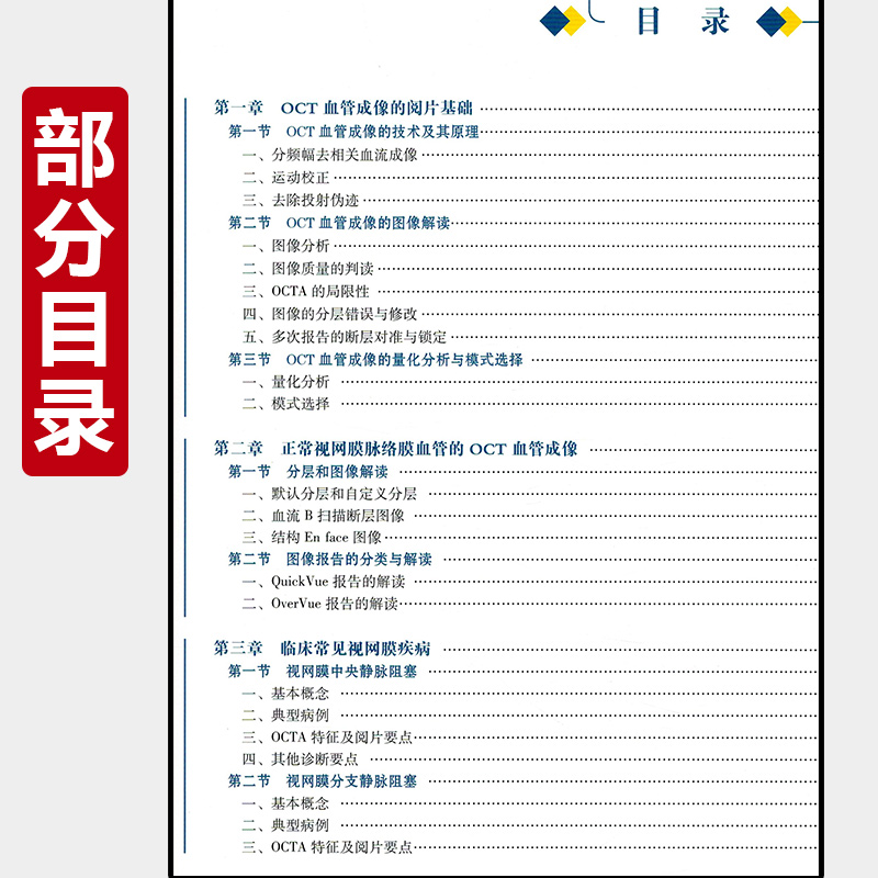 正版 OCT血管成像图谱影像分析与解读 适合刚入门掌握此项技术的临床医生 研究生及技术人员 蒋沁姚进人民卫生出版社9787117297813 - 图1