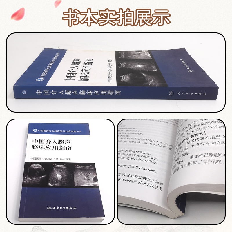 正版 中国介入超声临床应用指南 中国医师协会超声医师分会 编著 指南丛书 人民卫生出版社9787117242547 - 图1