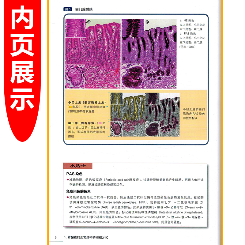 正版 从基础学起 胃癌病理 从胃黏膜正常结构以及分化直至胃活检诊断Group分型之路 日塚本彻哉 辽宁科学技术出版社9787559113122 - 图2