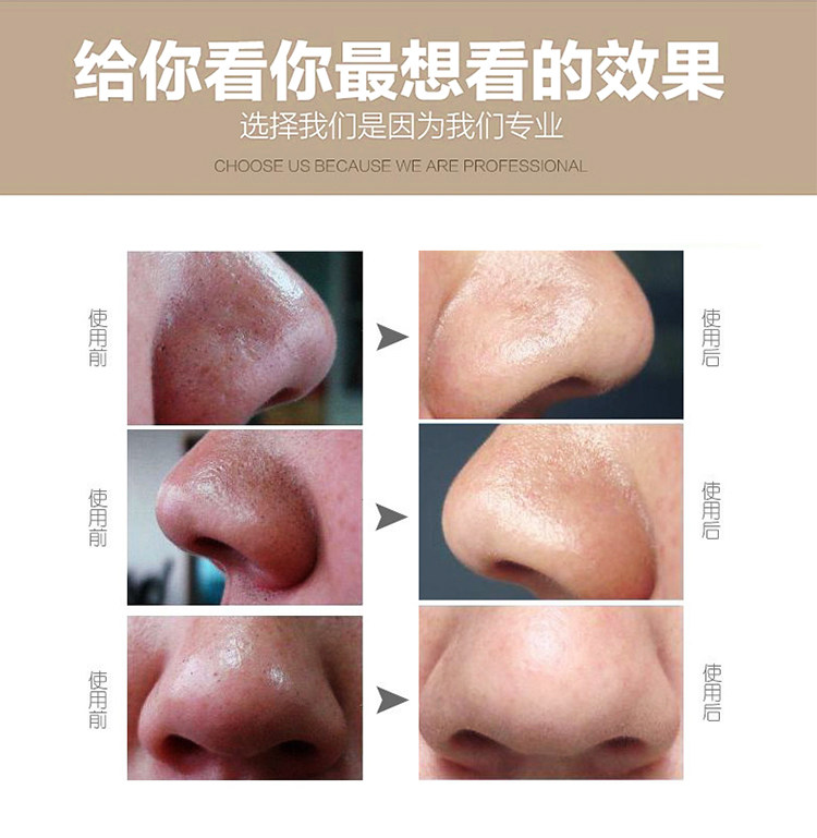 北美仪吸黑头清洁仪去粉刺油脂神器家用美容工具洁面仪美妆工具,淘宝优惠券,粉丝福利购,淘宝优惠卷