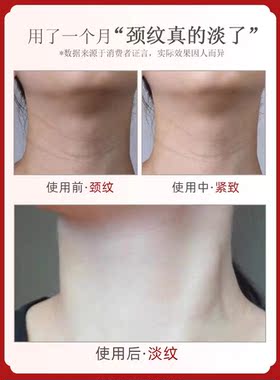小红书推荐萱晴正品淡纹皱颈纹颈膜颈霜紧致提拉脖子皱纹脖子皱纹