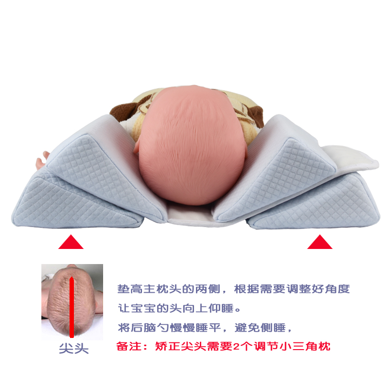 appocat旗舰店婴儿定型枕纠正头型枕0新生儿侧睡枕矫正防偏头左右偏头扁头平头12