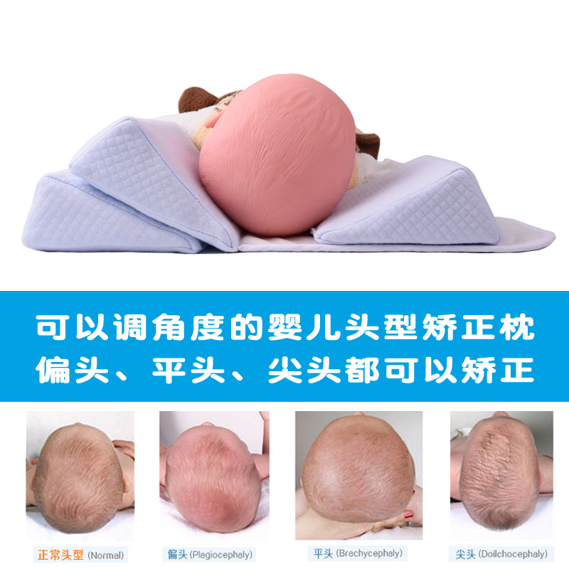 appocat旗舰店婴儿定型枕纠正头型枕0新生儿侧睡枕矫正防偏头左右偏头扁头平头10