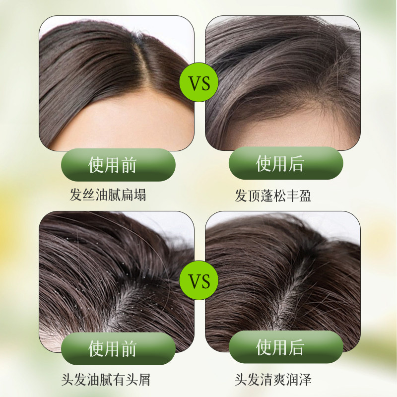 卓蓝雅生姜头皮按摩膏控油蓬松去屑舒缓深层清洁毛囊磨砂膏旅行装,淘宝优惠券,粉丝福利购,淘宝优惠卷