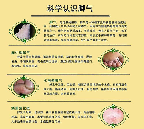 除臭鞋垫透气中药防臭男女适用舒适柔软四季运动棉布吸汗鞋垫促销 - 图1