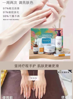 伊耐森手膜4件套磨砂补水滋润