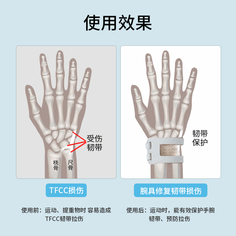 tfcc损伤护腕扭伤手腕腱鞘女关节护套运动羽毛球专用男健身薄腕带 - 图3