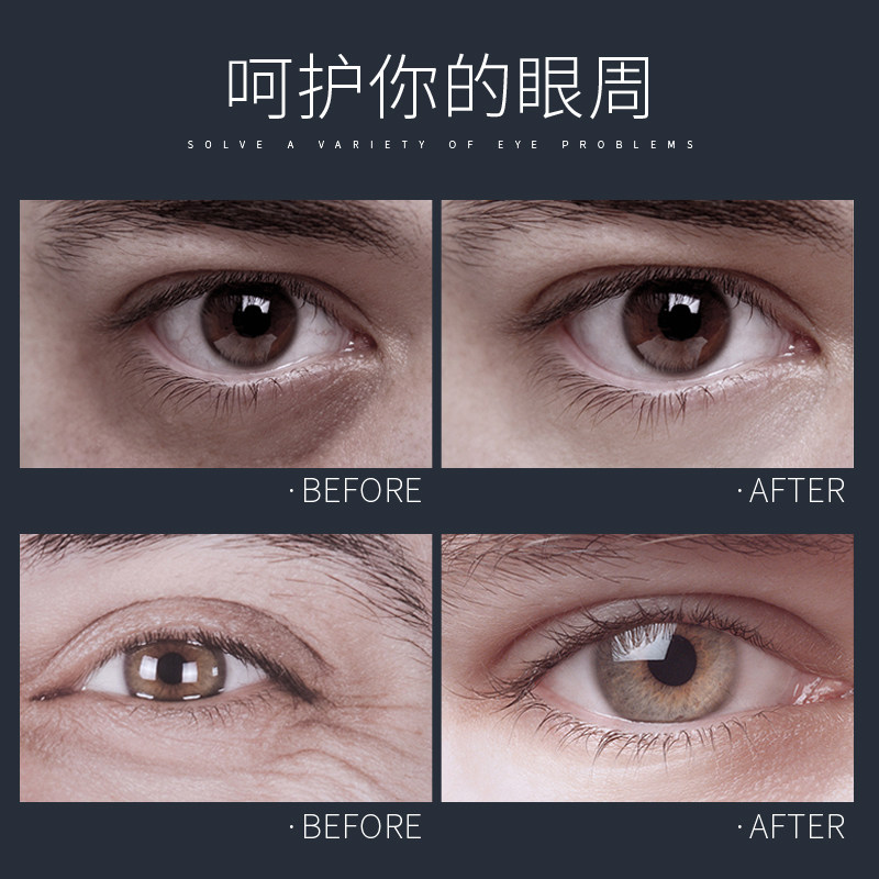 [买1送2]莱蔻男士日夜双管补水眼霜 莱蔻男士眼膜