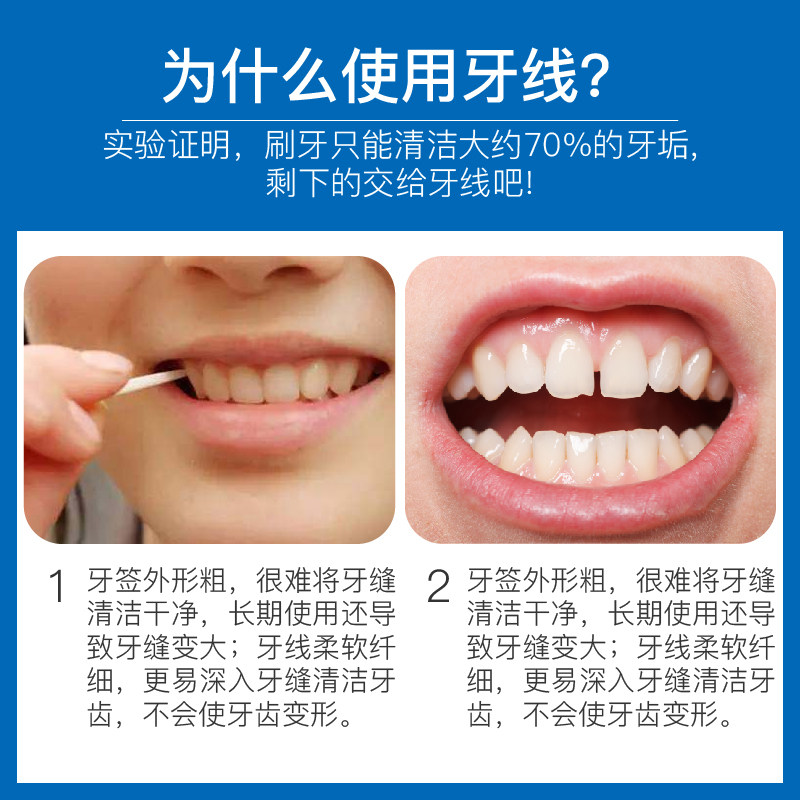  纳诺牙线/牙线棒