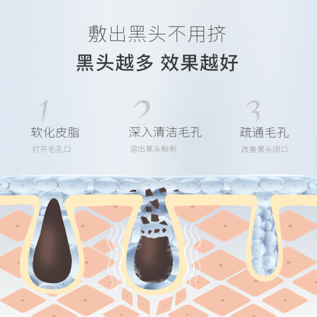 Jingkou blackhead patch ສົ່ງອອກຂອງແຫຼວ salon ຄວາມງາມພິເສດ