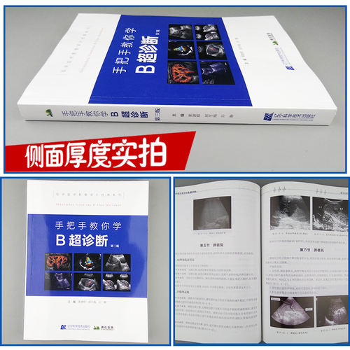 手把手教你学 B超诊断 第三版 医学影像图谱 超声诊断学书籍医师图像及鉴别技师超声检查技术手法 临床医学影像读片辅导入门 b超书 - 图0