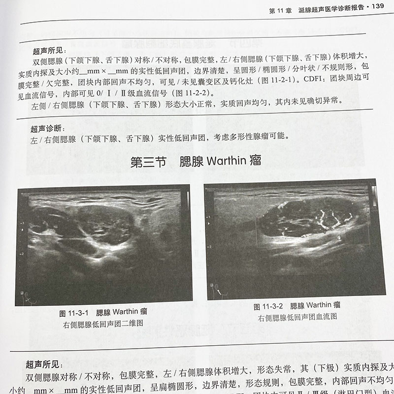 【新书】超声医学报告书写规范尹立雪程印蓉编腹部浅表器官妇产心脏血管儿童介入提供了常见病多发病超声医学诊断报告的模板科学出 - 图3