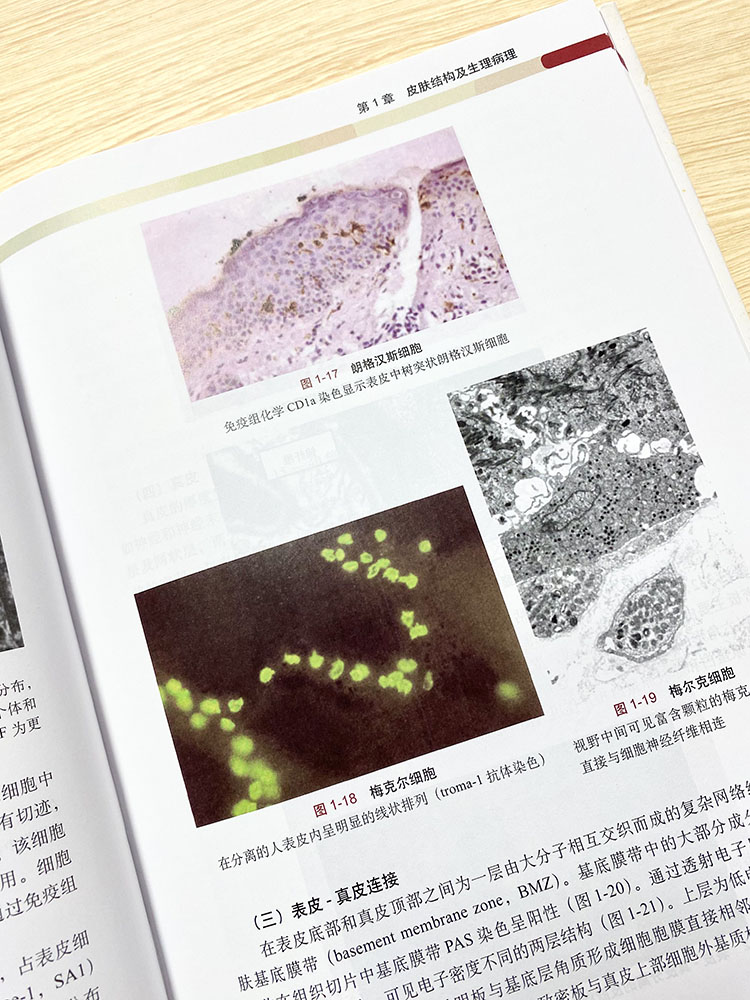 【现货】黄褐斑临床诊疗苑凯华等皮肤结构及生理病理色素代谢机制黄褐斑基础总论和黄褐斑临床总论联合临床治疗方案 - 图3