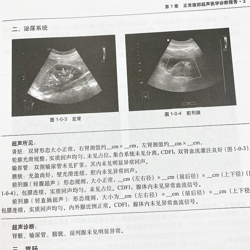 【新书】超声医学报告书写规范尹立雪程印蓉编腹部浅表器官妇产心脏血管儿童介入提供了常见病多发病超声医学诊断报告的模板科学出 - 图2