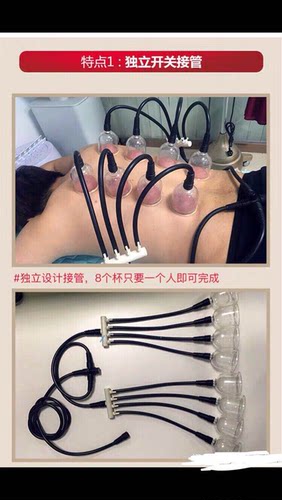 碧波家庭配件养生仪器分流阀拔罐杯四六通开关阀门长短软管调压阀 - 图2