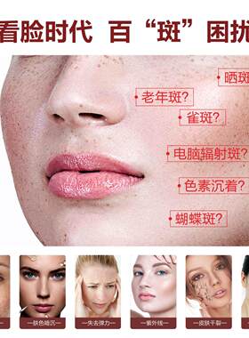 靓肤宝蜂皇浆护肤套装七件套淡化黑色素美白修护礼护肤品盒装