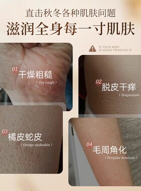 白云山止痒润肤露保湿滋润身体乳女秋冬男士皮肤干燥润肤乳正品