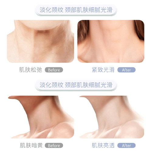 颈膜固定带可水洗颈部敷脖子面膜颈带硅胶颈纹贴护颈脖套辅助神器 - 图2