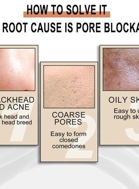 Lactobionic Acid Deep Cleansing Gentle Exfoliation Blackhead