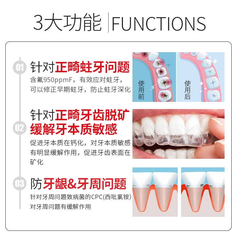 狮王护牙素日本Check-Up龋克菲矫正牙套专用正畸牙膏啫喱成人脱矿 - 图0