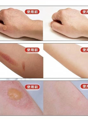 獾油纯正可食用治胃病烫伤痔疮用