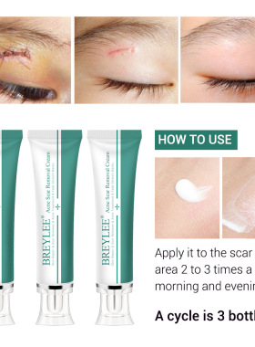 Acne Scar Removal Cream Face Repair Skin Whitening cream30g