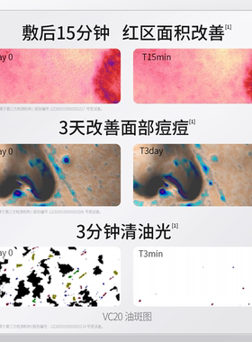 羽素祛痘湿敷棉片妆前护肤面膜贴
