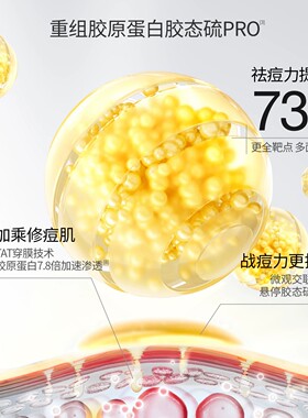 羽素大灯泡闭口水祛痘去闭口套组