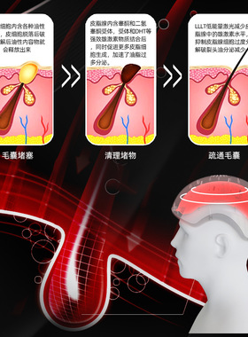 【2026新款】红光生发帽激光防脱发头盔生发仪LED红光护发帽护理