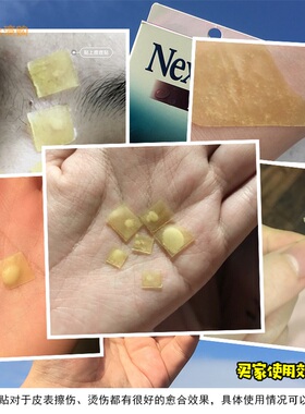 台湾3m人工皮自由剪切物理性港版痘痘贴人工皮