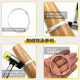 Bracelet plastic surgery ring expands orthodontic jewelry tools