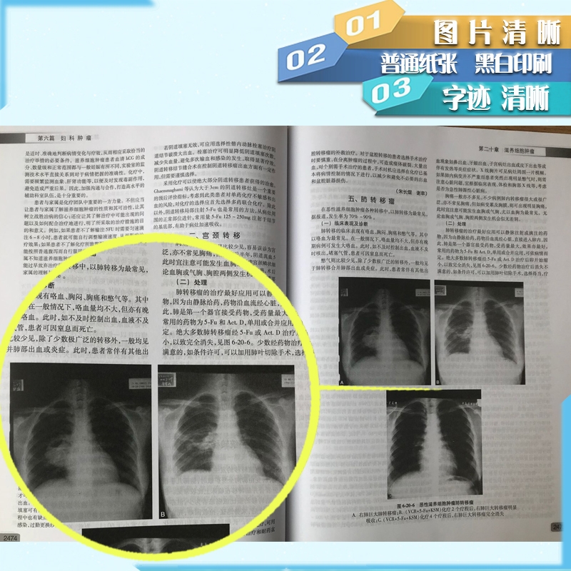 【包邮】中华妇产科学第3版第三版下册曹泽毅人民卫生出版社9787117181563-图0