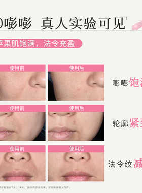 新加坡枫缇精华油面中丰盈紧塑美容胶囊淡化法令纹苹果肌下垂