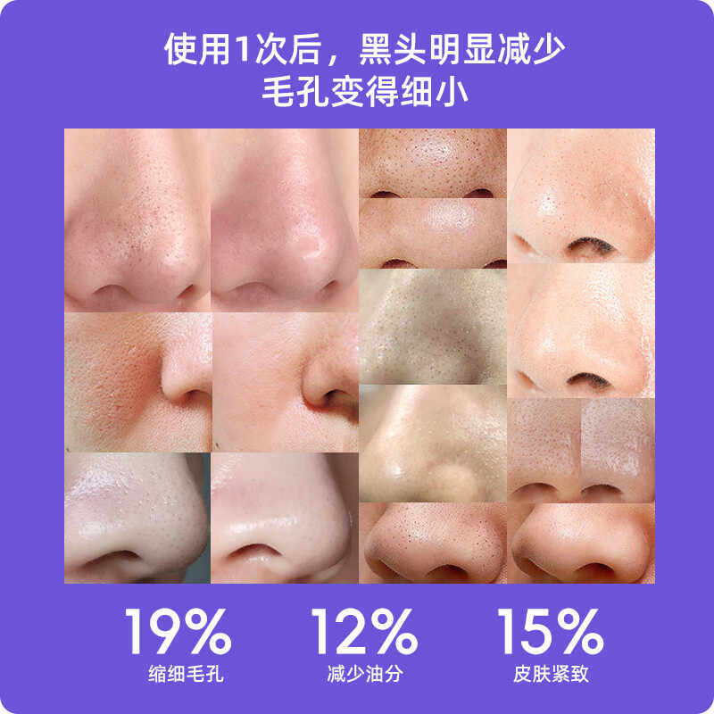 智能wifi可视化黑头仪电动吸黑头神器头毛孔清洁器美容院专用仪器,淘宝优惠券,粉丝福利购,淘宝优惠卷