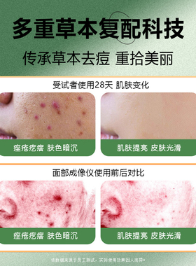 美容院祛痘粉刺净颜护理肌肤套盒