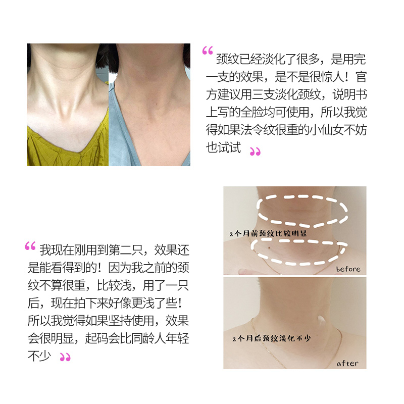 careplus海外旗舰店西班牙Xhekpon颈霜去颈部护理颈纹颈膜霜李佳琦提拉紧致嫩白神器3