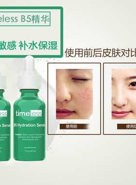 新包装 美国原装Timeless维生素B5精华30ML*2 修复敏感缓解发炎