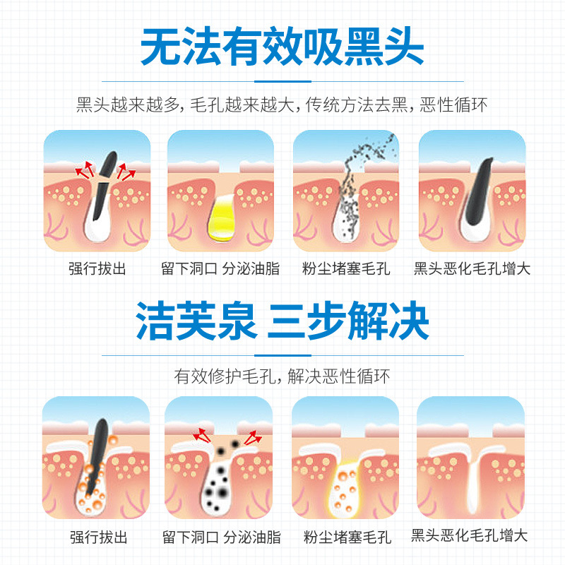 洁芙泉去黑头收缩毛孔套装 T区护理黑头导出液撕拉式鼻膜厂家直销