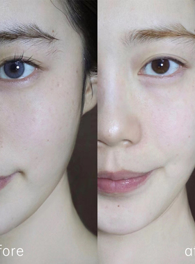 修丽可发光瓶臻白焕彩精华液